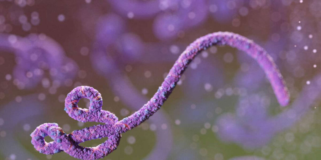 CDC Says America Must Be Prepared for Ebola Following Outbreak